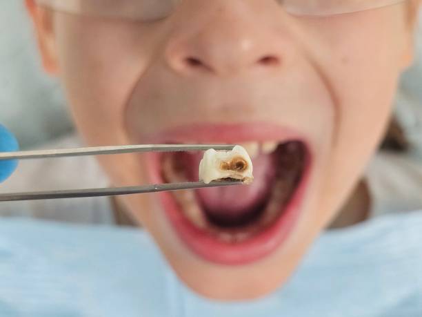Best Emergency Cosmetic Dentistry in Shady Side, MD