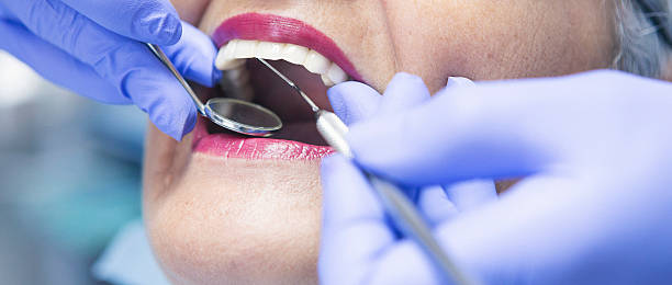 Best Emergency Dentist for Lost Fillings or Crowns in Shady Side, MD